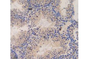 Used in DAB staining on fromalin fixed paraffin- embedded testis tissue (SSFA2 抗体  (AA 587-802))