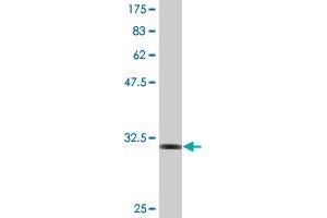 Western Blot detection against Immunogen (32. (RNF2 抗体  (AA 164-223))