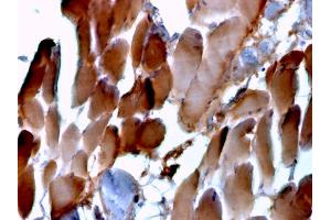 Formalin-fixed, paraffin-embedded human cardiac muscle stained with Sarcomeric Actinin Alpha 2 Mouse Monoclonal Antibody (ACTN2/3293). (ACTN2 抗体  (AA 557-692))
