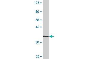 Western Blot detection against Immunogen (36. (Catalase 抗体  (AA 1-100))