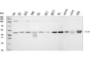 Western blot analysis of ATG4B using anti-ATG4B antibody (ABIN7599346).