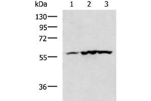 Western blot analysis of Mouse heart tissue Human heart tissue Rat heart tissue lysates using CAMK2G Polyclonal Antibody at dilution of 1:400 (CAMKII gamma 抗体)