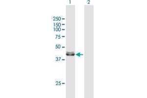 Western Blot analysis of ACADM expression in transfected 293T cell line by ACADM MaxPab polyclonal antibody. (Medium-Chain Specific Acyl-CoA Dehydrogenase, Mitochondrial (MCAD) (AA 1-421) 抗体)