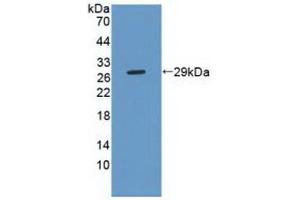 Detection of Recombinant PLCg2, Human using Polyclonal Antibody to Phospholipase C Gamma 2, Phosphatidylinositol Specific (PLCg2) (Phospholipase C gamma 2 抗体  (AA 930-1152))