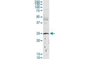 Western Blotting (WB) image for anti-Complement Component 1, Q Subcomponent, B Chain (C1QB) (AA 1-253) antibody (ABIN513854)