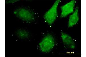 Immunofluorescence of monoclonal antibody to ZAK on HeLa cell. (ZAK 抗体  (AA 1-455))