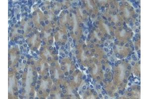 DAB staining on IHC-P; Samples: Mouse Kidney Tissue (CXCL11 抗体  (AA 22-100))