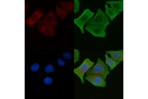ABIN6262532 and ABIN6276906 staining Hela cells by IF/ICC. (IL-10RA 抗体  (C-Term))