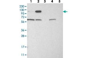 Western blot analysis of Lane 1: RT-4, Lane 2: U-251 MG, Lane 3: Human Plasma, Lane 4: Liver, Lane 5: Tonsil with IGSF9 polyclonal antibody . (IGSF9 抗体)