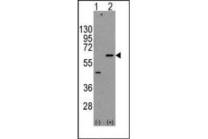 Western Blotting (WB) image for anti-V-Akt Murine Thymoma Viral Oncogene Homolog 3 (Protein Kinase B, Gamma) (AKT3) (Ser472) antibody (ABIN359084)