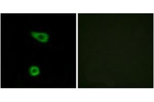 Immunofluorescence analysis of HuvEc cells, using TNAP2 Antibody. (TNFAIP2 抗体  (AA 131-180))