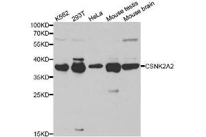 Western blot analysis of extracts of various cell lines, using CSNK2A2 antibody. (CSNK2A2 抗体  (AA 1-350))