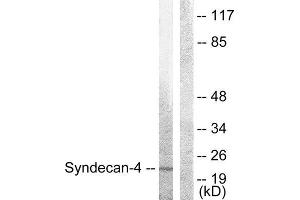 Western Blotting (WB) image for anti-Syndecan 4 (SDC4) (Ser179) antibody (ABIN1848043) (SDC4 抗体  (Ser179))
