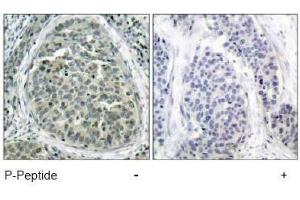 Image no. 1 for anti-Catenin (Cadherin-Associated Protein), beta 1, 88kDa (CTNNB1) (pSer37) antibody (ABIN196958) (CTNNB1 抗体  (pSer37))