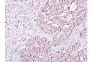 IHC-P Image Immunohistochemical analysis of paraffin-embedded NCIN87 xenograft , using FARSLA , antibody at 1:500 dilution.
