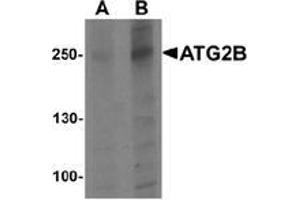 Western blot analysis of ATG2B in K562 cell lysate with ATG2B Antibody  at (A) 1 and (B) 2 μg/ml. (ATG2B 抗体  (N-Term))