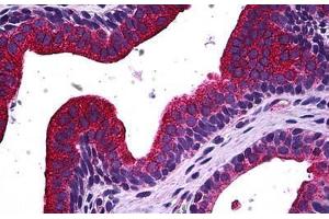 Human Prostate: Formalin-Fixed, Paraffin-Embedded (FFPE) (MAPK13 抗体  (AA 251-365))