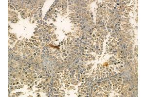 FAS Mouse Monoclonal Antibody at 1/100 staining mouse testis tissue by IHC-P. (FAS 抗体)