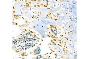 Immunohistochemistry (Paraffin-embedded Sections) (IHC (p)) image for anti-Sp7 Transcription Factor (SP7) antibody (ABIN7075694)