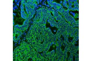 IF analysis of SUCLG2 using anti-SUCLG2 antibody (ABIN7601694).