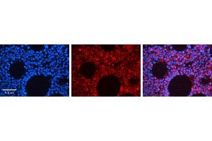 Immunohistochemistry (IHC) image for anti-Mitogen-Activated Protein Kinase 14 (MAPK14) (C-Term) antibody (ABIN2792183)