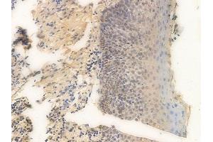 ABIN6265700 and ABIN6266665 at 1/100 staining human normal tonsil tissue by IHC-P. (TRADD 抗体  (N-Term))
