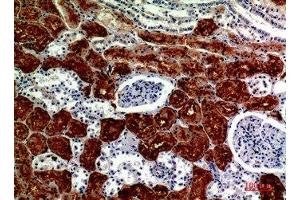 Immunohistochemical analysis of paraffin-embedded human-kidney, antibody was diluted at 1:200
