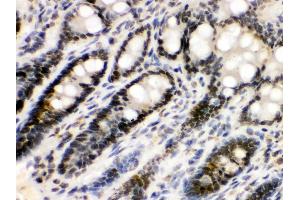 Anti- EME1 Picoband antibody,IHC(P) IHC(P): Rat Intestine Tissue (Crossover junction endonuclease EME1 (EME1) (AA 520-561), (C-Term) 抗体)