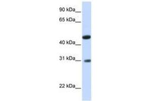 Image no. 1 for anti-Glycolipid Transfer Protein Domain Containing 2 (GLTPD2) (AA 36-85) antibody (ABIN6740898) (GLTPD2 抗体  (AA 36-85))