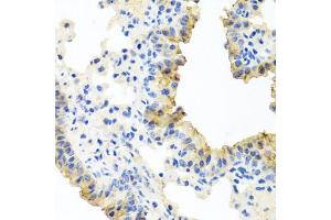 Immunohistochemistry (IHC) image for anti-Ferrochelatase (FECH) (AA 1-200) antibody (ABIN6140573)