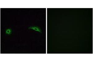 Immunofluorescence analysis of A549 cells, using OR2J2 Antibody. (OR2J2 抗体  (AA 263-312))