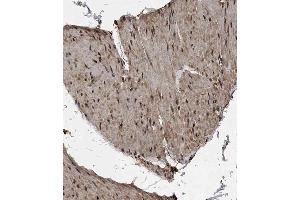 Immunohistochemical analysis of B on paraffin-embedded Human bladder tissue. (MET10 (AA 444-472), (C-Term) 抗体)