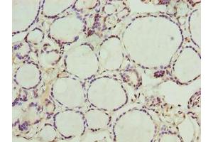 Immunohistochemistry of paraffin-embedded human thyroid tissue using ABIN7161975 at dilution of 1:100 (NOL4L (AA 101-300) 抗体)