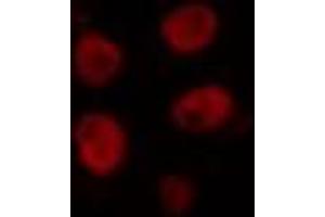 ABIN6274356 staining COLO205 cells by IF/ICC. (HLX 抗体  (Internal Region))