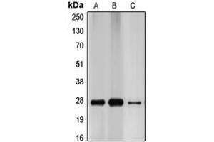 Western blot analysis of p27 Kip1 expression in MCF7 (A), HEK293T (B), PC12 (C) whole cell lysates. (CDKN1B 抗体  (C-Term))