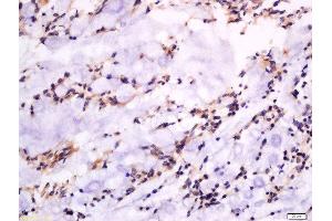 Formalin-fixed and paraffin embedded rat rectum labeled with Anti-GSDMA Polyclonal Antibody, Unconjugated  at 1:300 followed by conjugation to the secondary antibody and DAB staining. (Gasdermin A 抗体  (AA 21-120))