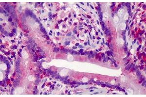 Human Small Intestine: Formalin-Fixed, Paraffin-Embedded (FFPE) (Caspase 7 抗体)