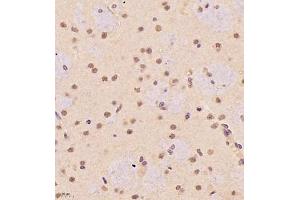 Immunohistochemistry of paraffin embedded rat brain using SR140 (ABIN7076091) at dilution of 1:1000 (400x lens) (SR140 抗体)