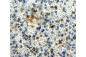 IHC-P analysis of Spleen tissue, with DAB staining. (GM-CSF 抗体  (AA 18-144))