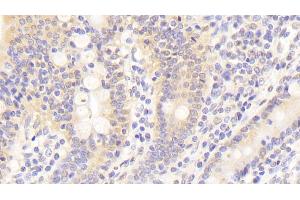 Detection of KNG1 in Human Small intestine Tissue using Polyclonal Antibody to Kininogen 1 (KNG1) (KNG1 抗体  (AA 390-644))