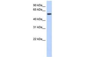 Image no. 1 for anti-Deoxynucleotidyltransferase, terminal (DNTT) (C-Term) antibody (ABIN6743611) (TdT 抗体  (C-Term))