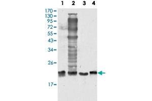 Western blot analysis of SOD1 monoclonal antobody, clone 6F5  against HeLa (1), NIH/3T3 (2), A-549 (3) and A-431 (4) cell lysate. (SOD1 抗体)