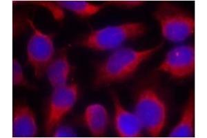 Image no. 1 for anti-Myristoylated Alanine-Rich Protein Kinase C Substrate (MARCKS) (Ser158) antibody (ABIN197560) (MARCKS 抗体  (Ser158))