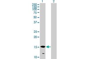 Western Blot analysis of GALNT3 expression in transfected 293T cell line by GALNT3 MaxPab polyclonal antibody. (GALNT3 抗体  (AA 1-141))