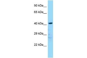 WB Suggested Anti-Ldb2 Antibody Titration: 1. (LIM Domain Binding 2 Protein 抗体  (N-Term))