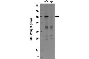 Immunoblot against lysates from wild-type (+/+) and RGS14 knockout (-/-) mouse brains probed with N133/21. (RGS14 抗体  (AA 1-544))