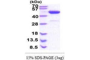 SDS-PAGE (SDS) image for phosphoribosylaminoimidazole Carboxylase, phosphoribosylaminoimidazole Succinocarboxamide Synthetase (PAICS) (AA 1-425) protein (His tag) (ABIN5853635)