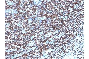Immunohistochemistry (IHC) image for anti-Histone H1 antibody (ABIN6939596)