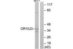 Western blot analysis of extracts from MCF-7 cells, using OR10J3 Antibody. (OR10J3 抗体  (AA 237-286))