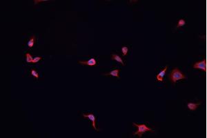 ABIN6267044 staining A-431 cells by IF/ICC. (NF-kB p65 抗体  (C-Term))